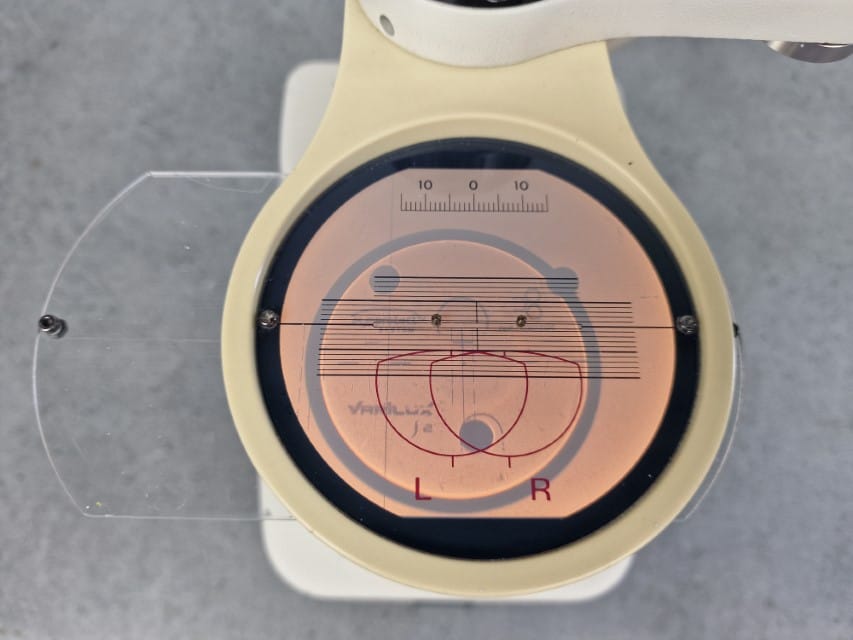 NIDEK CE-1 - Image 7